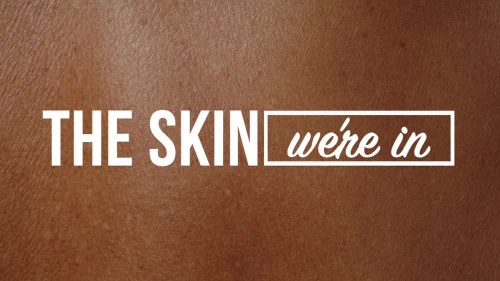 The Skin We\'re In